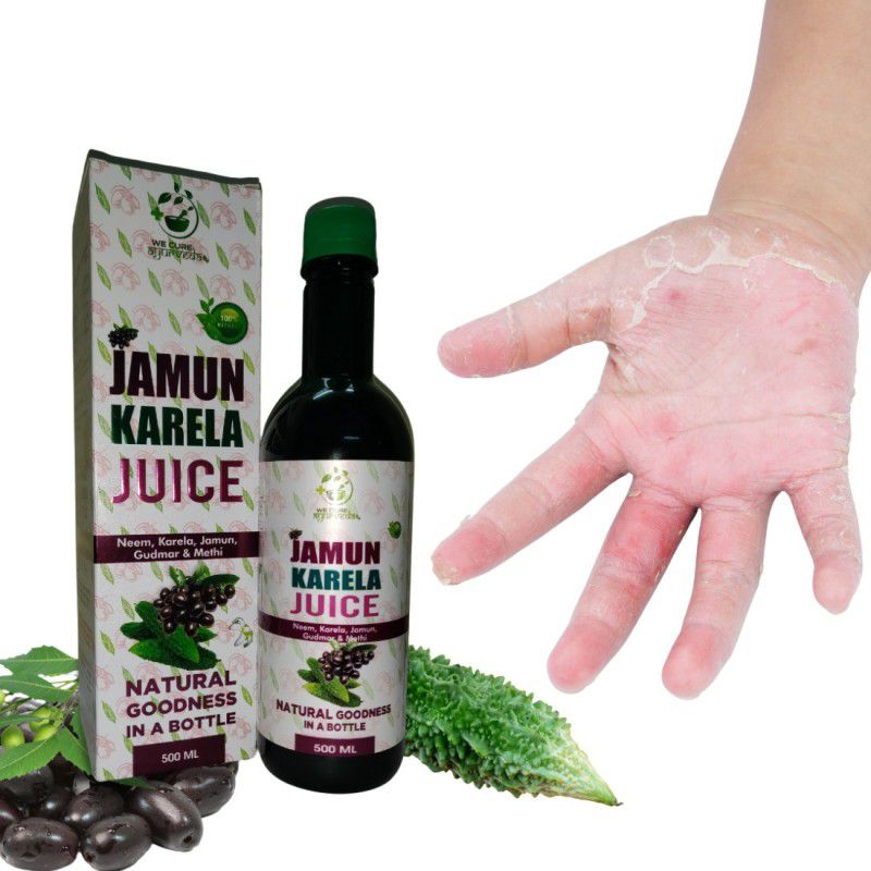 wecureayurveda Jamun karela Juice Treating Respiratory Disorders, Viral&Fungal Infection 500 ML  (500 ml)