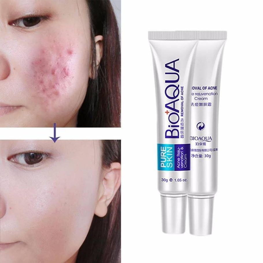 Bioaqua Anti Acne Cream - 30g