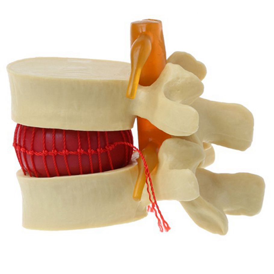 Lumbar Vertebrae Model Anatomical Spine Lumbar Disc Herniation Anatomy Teaching Tool Lumbar Vertebrae Model